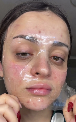 Before using hydrogel melting mask